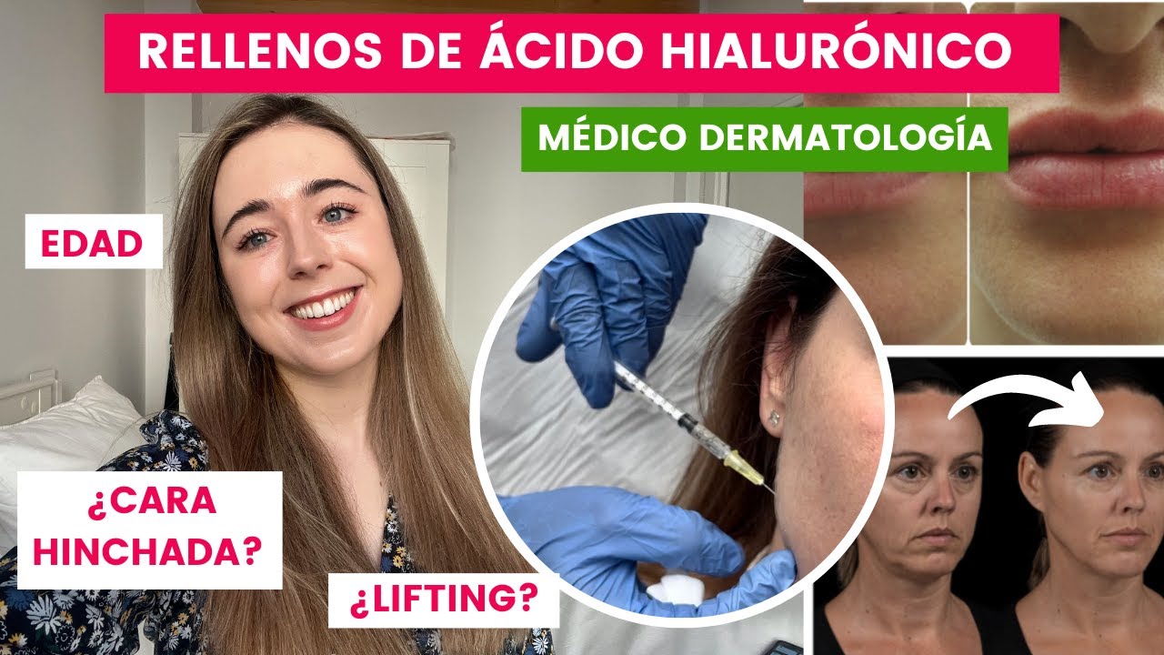 MÉDICO EXPLICA RELLENOS HIALURÓNICO: LABIOS, OJERA, NARIZ, LIFTING | EDAD, EFECTOS SECUNDARIOS 2023