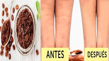 ¿Beber cafeína ayuda a combatir la celulitis?