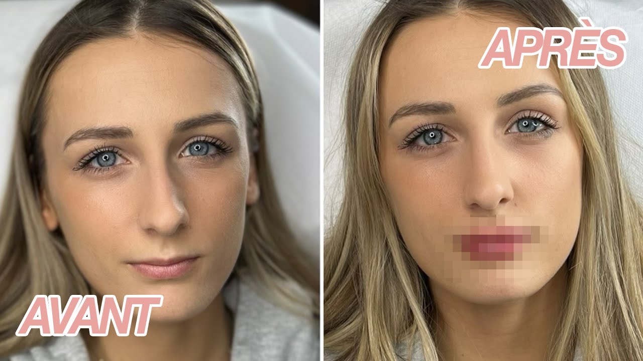 MES NOUVELLES LÈVRES