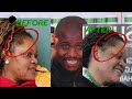 Real Hair Growth Results | Before vs After Transformation 👀