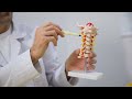 Cervical Spine Narrowing: Symptoms, Diagnosis and Treatment Options