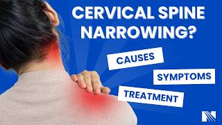 Cervical Spine Narrowing: Symptoms, Diagnosis and Treatment Options