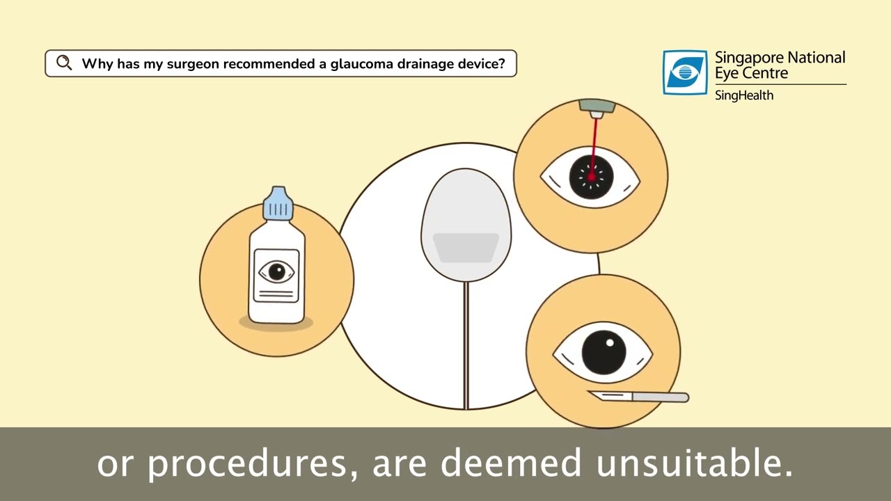 Glaucoma Drainage Devices