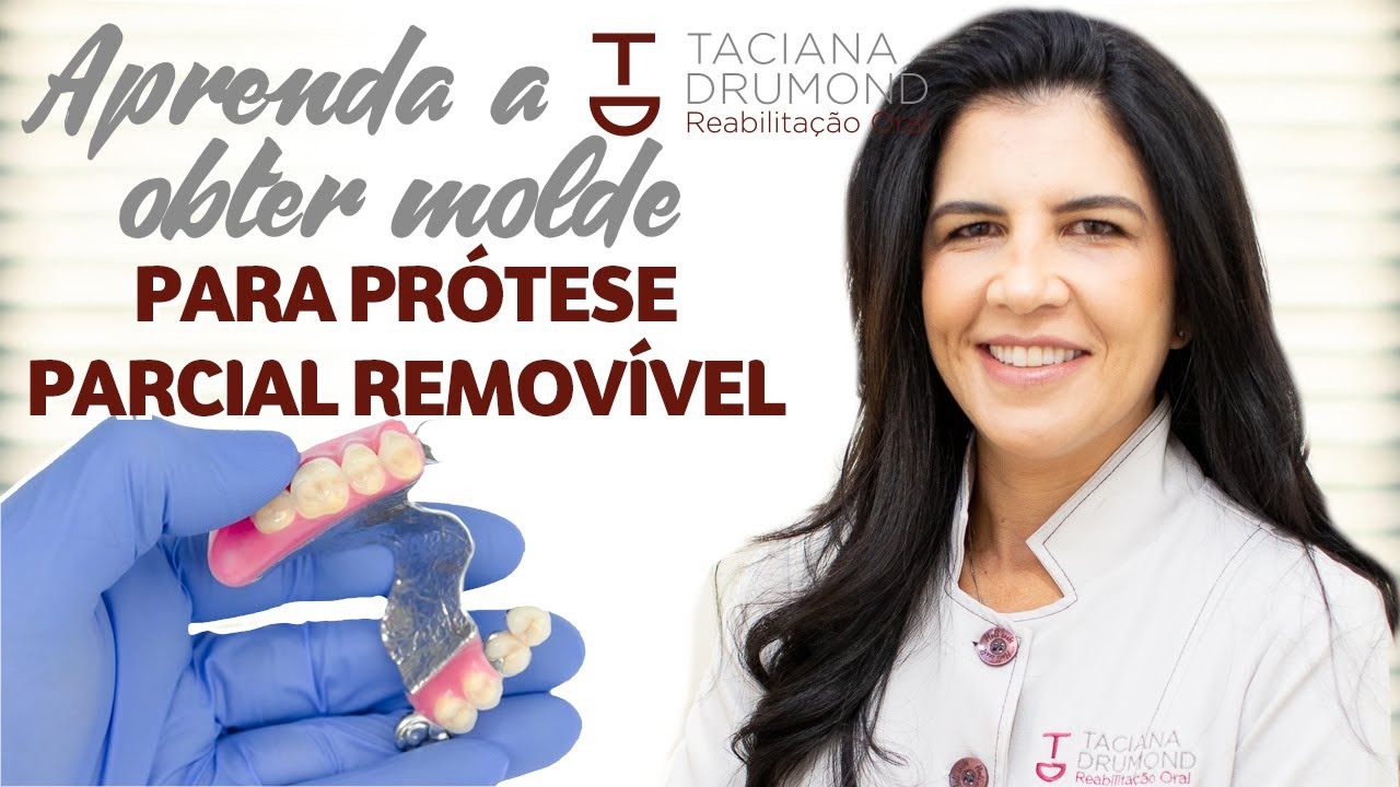 Os Segredos da Moldagem para Prótese Parcial Removível | Materiais, passo a passo e dicas