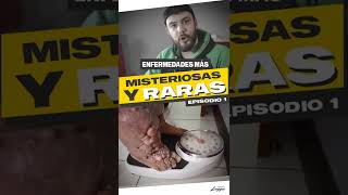 Enfermedades Más Misteriosas Y Raras Del Mundo