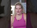 My rare condition means I can't smile #truly #borndifferent #rarecondition #shorts #youtubeshorts