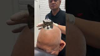 Sering Pusing U0026 Dunia Terasa Muter Coba Bekam Kepala Untuk Vertigo