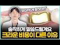 크라운 비용 치과마다 다른 이유 치료받기 전에 영상 보고 가세요 치과 크라운 종류와 특징 가격이 다른 이유 크라운 비용 치과마다 다른 이유 치료받기 전에 영상 보고 가세요 치과 크라운 종류와 특징 가격이 다른 이유