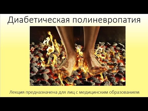 Диабетическая полиневропатия