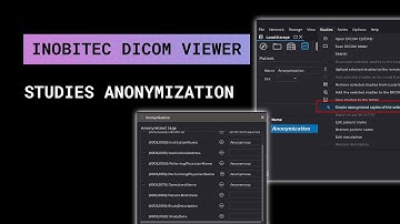Studies anonymization with Inobitec DICOM Viewer