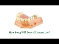Dental Crowns Longevity: How Long Do They Last? 🦷
