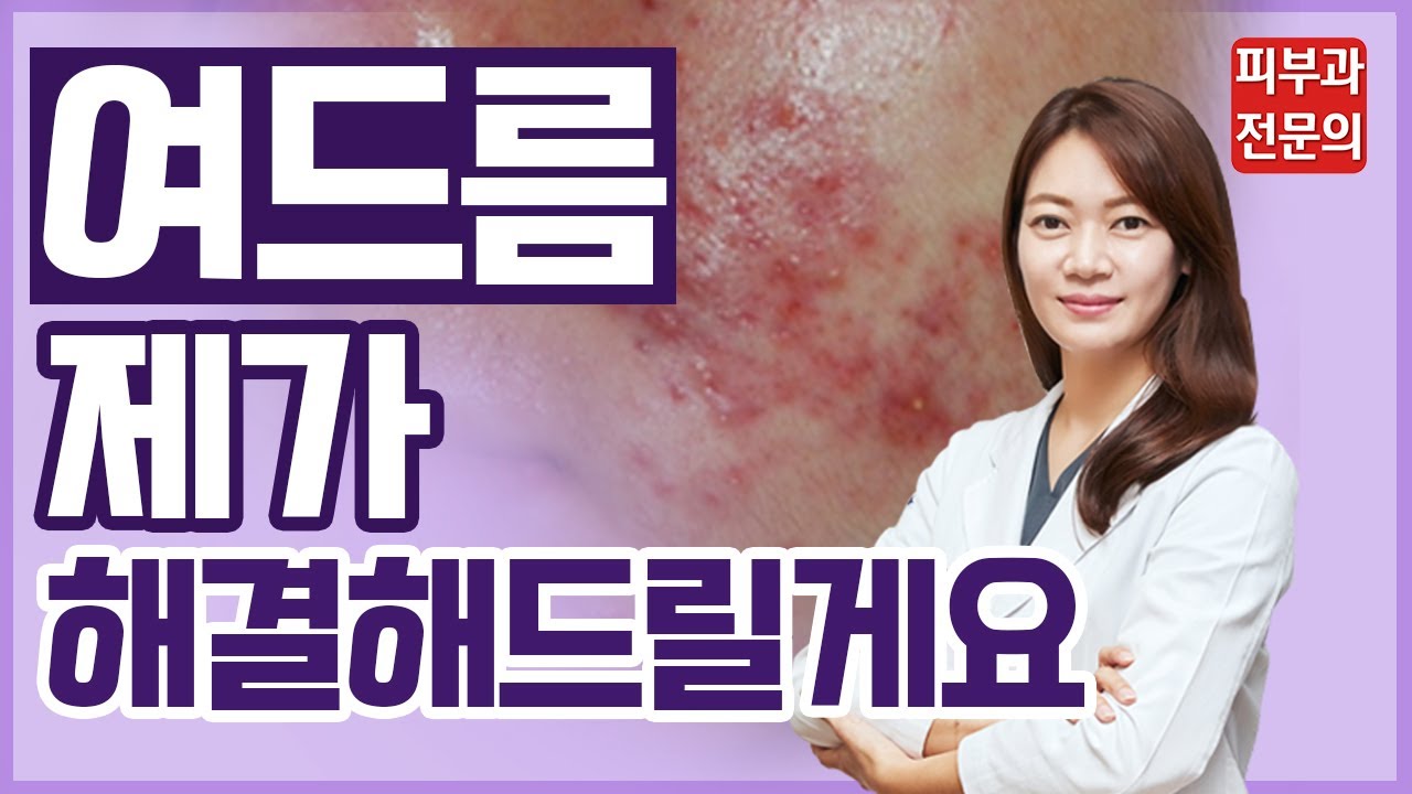 화농성 여드름의 원인을 이렇게 해결 8