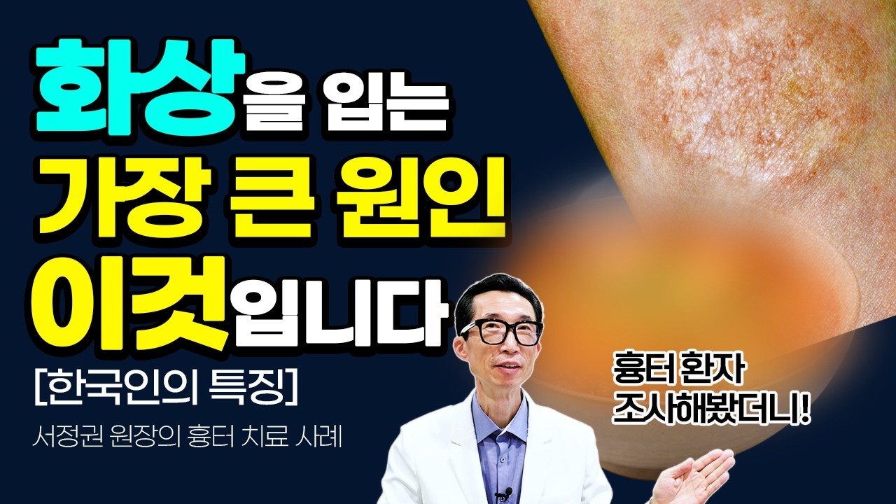 하얗게 남은 화상흉터, 치료 과정을 끝까지 보여드립니다❤️