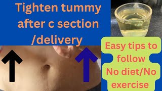 Best methods to lift tummy after Cesarean/Normal delivery. How to slim down stomach