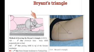 How to draw Bryant's triangle