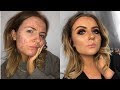 ACNE MAKEUP TUTORIAL FULL FACE OF REVOLUTION PRODUCTS