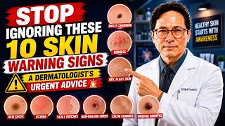 Stop Ignoring These 10 Skin Warning Signs — A Dermatologist's Urgent Advice