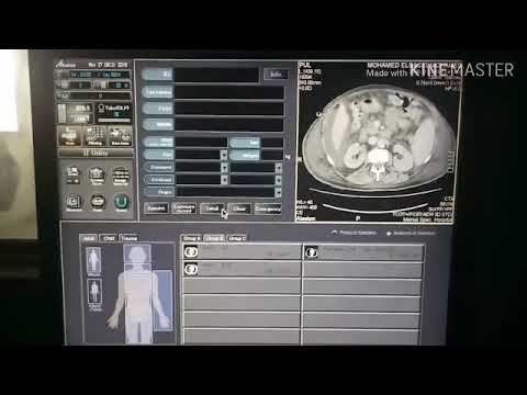 السوفت وير جهاز اشعة مقطعية توشيبا     