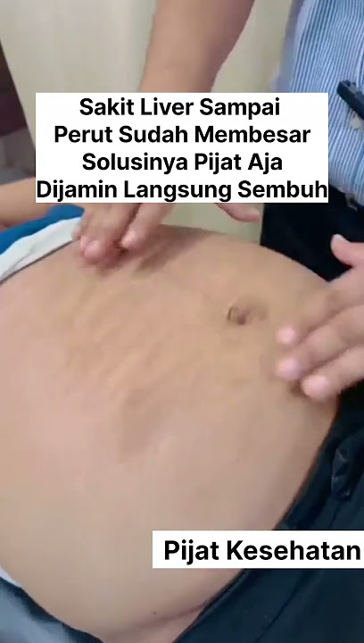 Sakit Liver sampai perut sudah membesar solusinya pijat aja dijamin langsung sembuh #abj #shorts