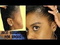 Let&#39;s Grow Our Edges! with Jamaican Black Castor Oil serum NaturAll Club