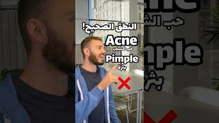 النطق الصحيح acne/pimple حب الشباب/بثرة ✅??