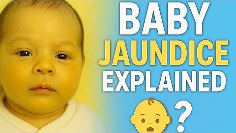 Jaundice in Newborns : Early signs to look out for.