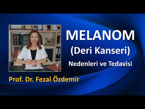 Video: Akral lentiginöz melanoma xoşxassəli ola bilərmi?