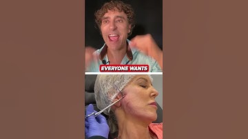 PDO THREADLIFT DEMO !!