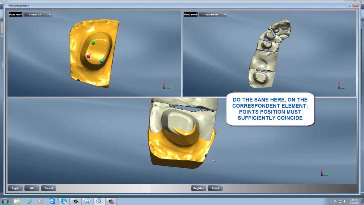 DentalCad - Multidie acquisition (OLD VERSION)