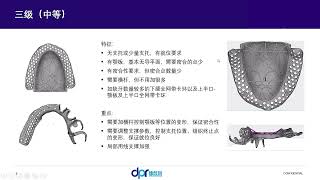 Todays Knowledge Point Full Network, Local Small Card, Large Board And Other Support Methods