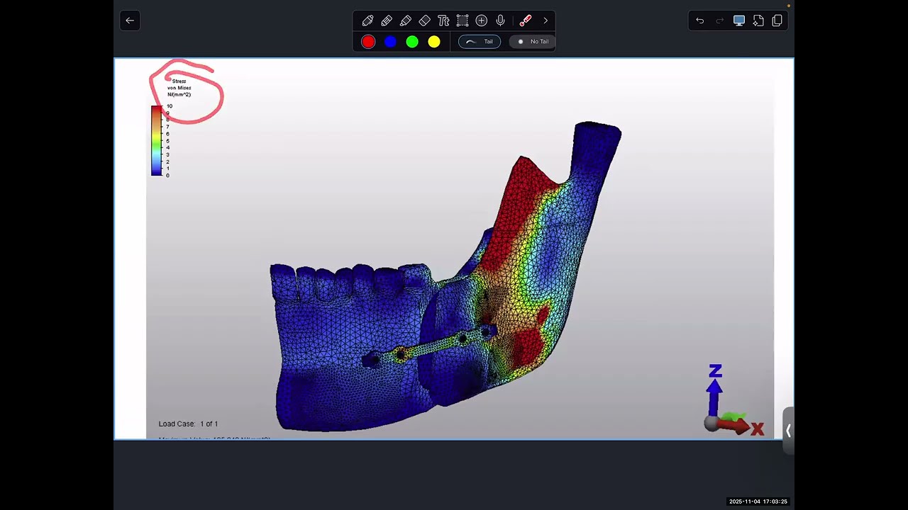 Stress Analysis in Orthodontics, Guest lecture at UF college of dentistry