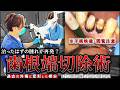 【治ったはずの腫れが再発？】過去の外傷と変形した根尖 抜歯回避の歯根端切除術