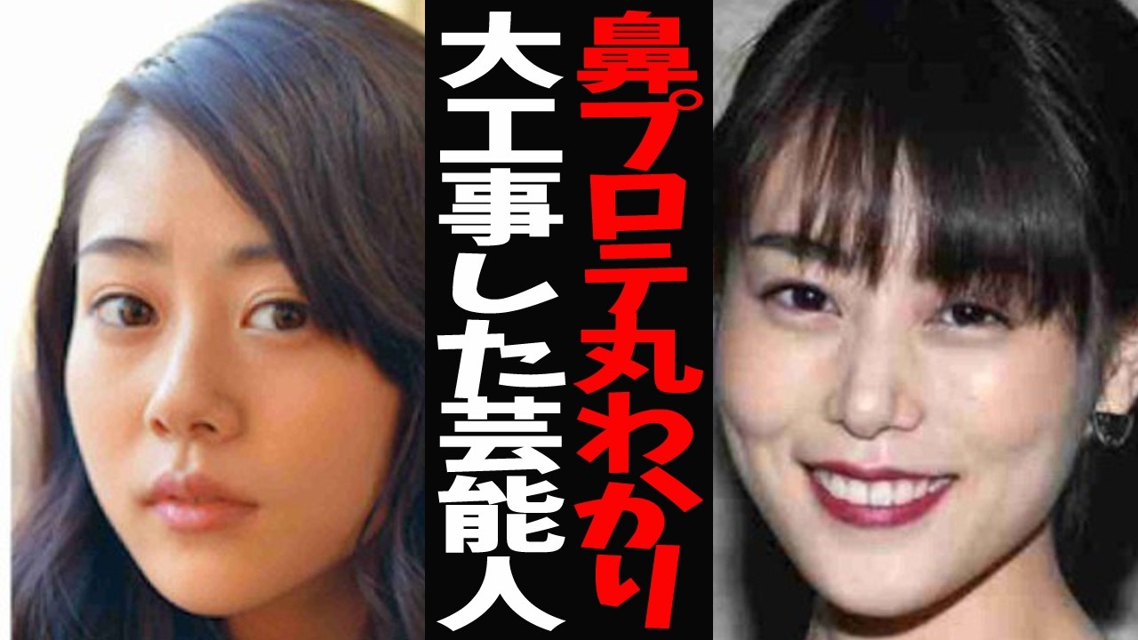 【ガルちゃん芸能】鼻プロテがっつり？気になる芸能人【有益2ch】