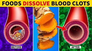 Top 7 Foods That Dissolve Blood Clots | Wikiaware