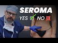 Liposuction Fluid Pockets: What’s Normal After Lipo & BBL