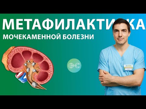 Метафилактика мочекаменной болезни