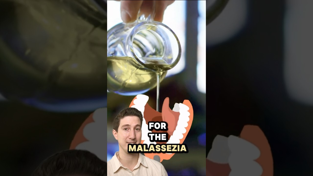 These Oils Cause Dandruff