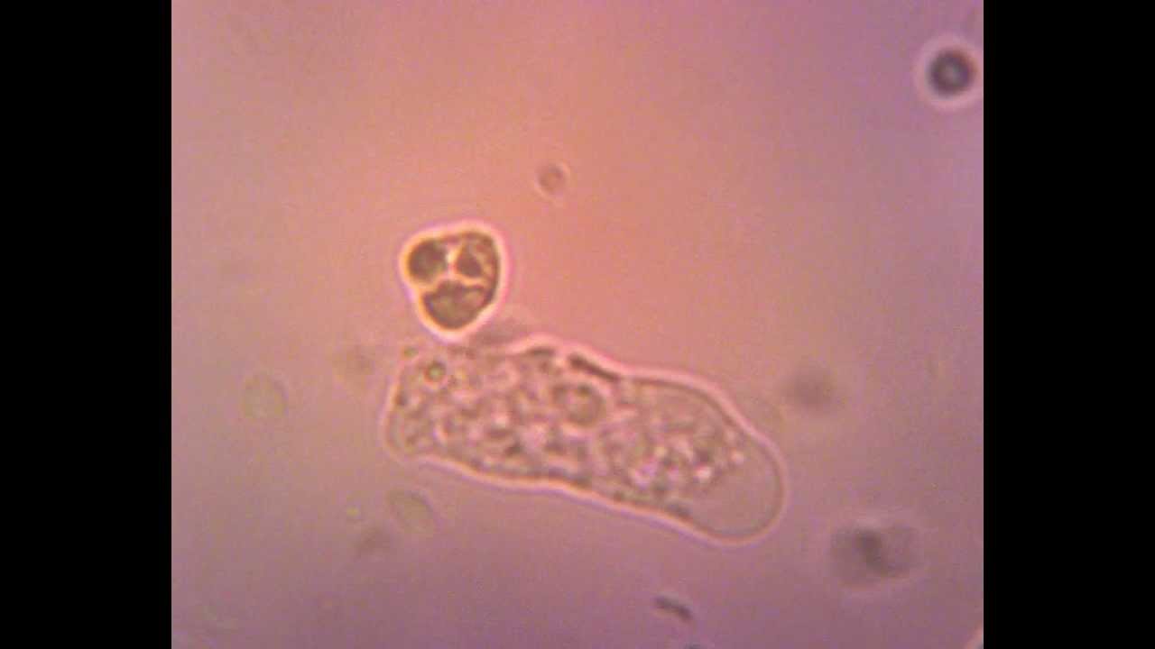 microscopic view of amoeba youtube