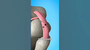 Hyperextending Your Knee Explained 