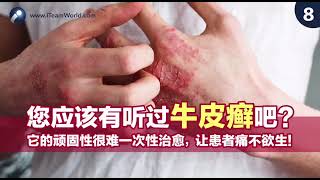 🌵 RosyTime 恋玫 | 牛皮藓救星