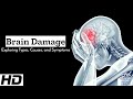Brain Damage Decoded Breaking Down Types Causes And Symptoms Brain Damage Decoded Breaking Down Types Causes And Symptoms