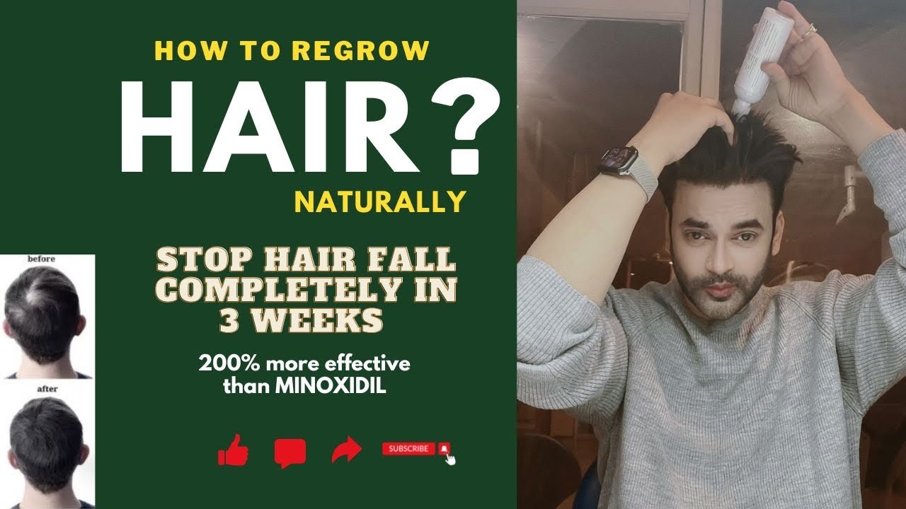 Grow Hair Naturally without Minoxidil Stop Hair Fall Completely in 3