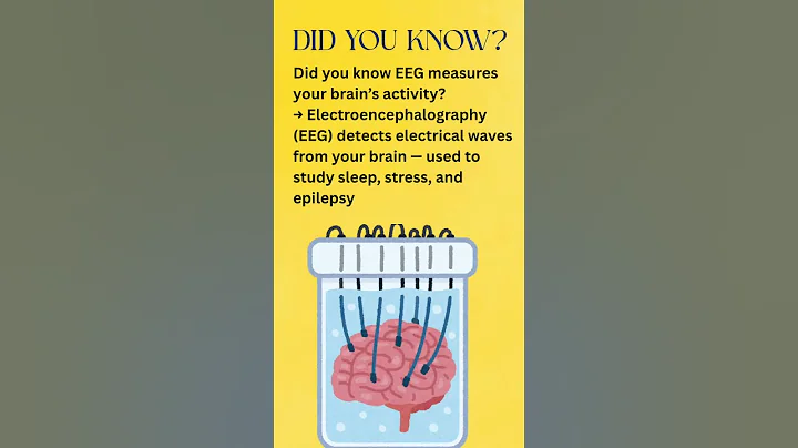 Did You Know Eeg Reads Your Brain’s Electrical Activity?