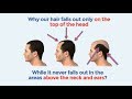 Best Hair loss treatment | How to stop hair loss naturally and baldness cure 2018