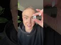 🥹 135 dni za mną 3,9 cm włosów !! #łysienieplackowate #ritlecytynib #alopeciaareata #bald