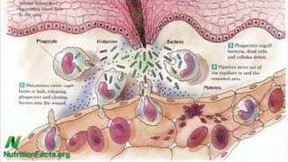 Chicken, eggs, and inflammation