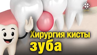 🤍 What is Dental Cyst Surgery? How is it Performed? - Lema Dental Clinic