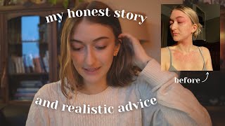 completely HEALING my severe chronic eczema || my holistic skin-healing journey by Grace Nevitt 24,096 views 4 months ago 27 minutes