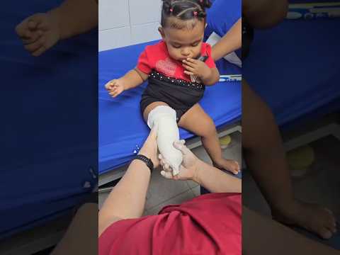 Amputee walking ' sweet baby girl leg Amputee's triumph' walking Overcoming Adversity