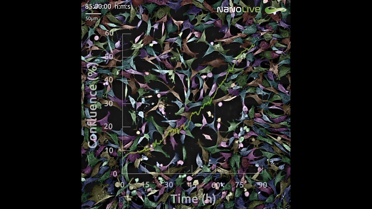 Label-free live cell imaging phenotypic variation in single cells. Webinar now available on demand!
